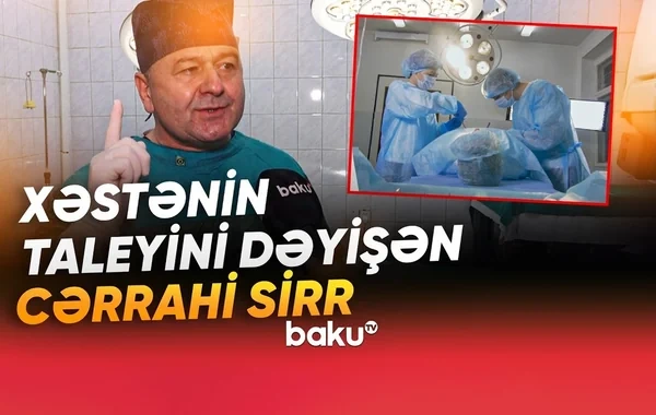 Cərrahlar niyə yaşıl və göy geyinirlər? - Səbəbi təəccübləndirir - VİDEO