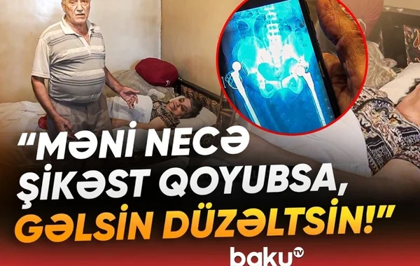 Qadının sol ayağının yerinə sağ ayağı əməliyyat edilib? - "Həkim dedi ki, qayıtmayacağam" - VİDEO