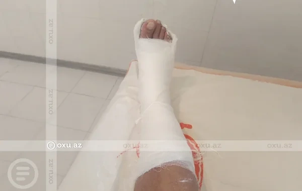 TƏBİB Sabunçu Tibb Mərkəzində pasiyentin öz hesabına gips alması iddialarına aydınlıq gətirdi
