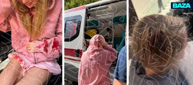 Qəbələdə turist meymunla şəkil çəkdirərkən başından yaralandı - Foto