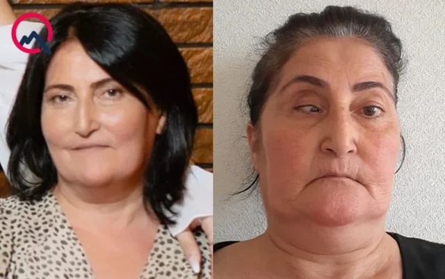 Məşhur klinika qüsurlu əməliyyata görə pasiyentə təzminat ödəyəcək - FOTO - VİDEO