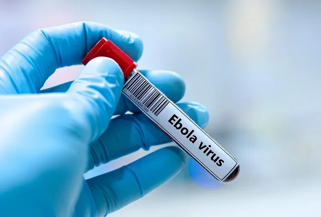 Konqoda Ebola sürətlə yayılır: Yoluxanların yarıdan çoxu ölüb