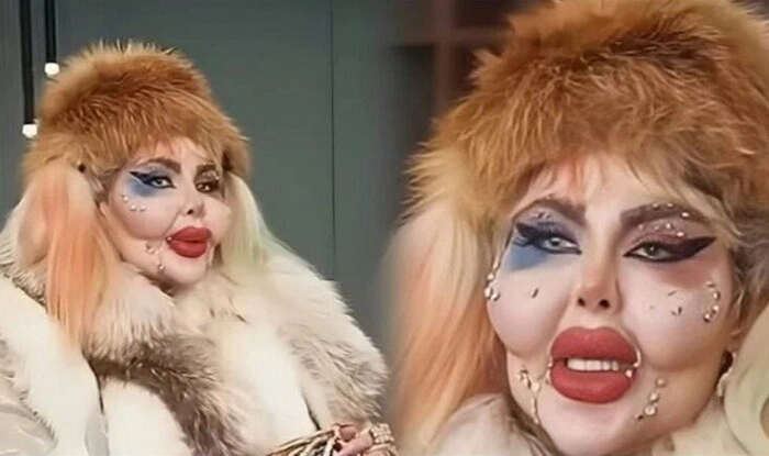 Anahita 388 kosmetik əməliyyat keçirdi