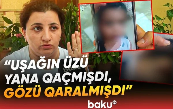 Bağçada dəhşətə gətirən hadisə: "İki aydır həkimlərdəyik" - VİDEO