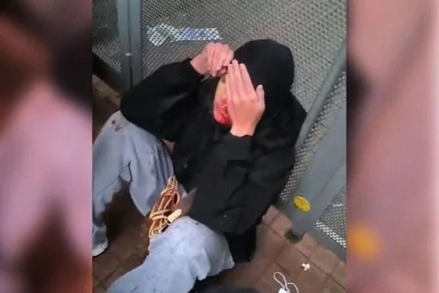 Fransada iğtişaşlar: 17 yaşlı qız gözünü itirdi, Luvr muzeyinə giriş məhdudlaşdırıldı - Foto