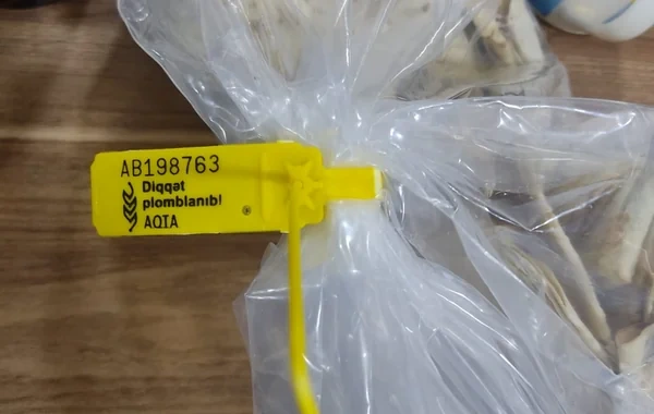 Azərbaycanda baş verən qida zəhərlənmələri araşdırıldı: Bakteriyalar aşkar olundu - FOTO