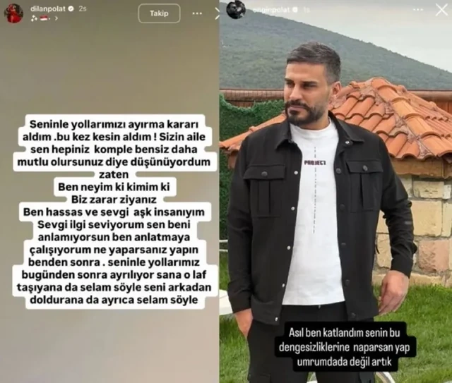 Dilan Polat-Engin Polat cütülüyü boşanır: Bir-birinə sərt sözlər dedilər - FOTO