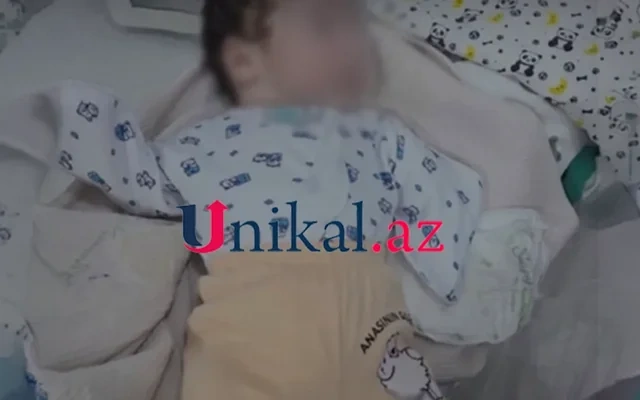 Bakıda qolları olmayan körpə doğuldu: Anası İMTİNA ETDİ - FOTO