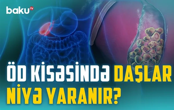 Öd və qaraciyər xəstəlikləri: Əməliyyat hansı halda şərtdir? - VİDEO