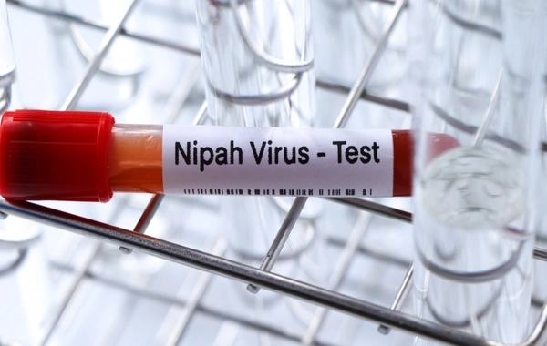 Nipah virusunu vaxtında müəyyənləşdirməyin yolları