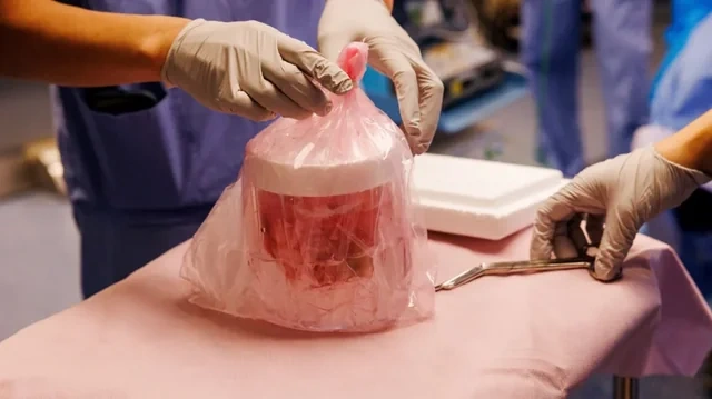 Dünyada İLK: Donuz böyrəyi ilə doqquz ay yaşadı, sonra insan orqanı köçürüldü - FOTO