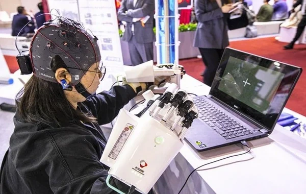 Çin beyin implantlarının istifadəsini təsdiqlədi - Tibdə ilk