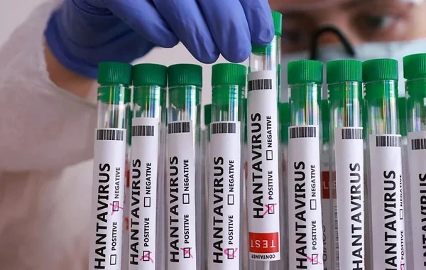 Fransada hantavirusa ilk yoluxma təsdiqləndi