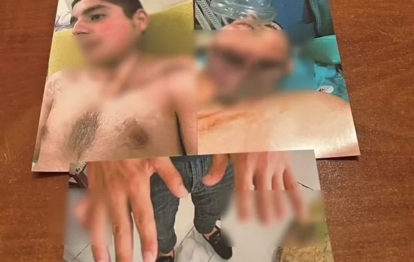 Əlillik ala bilməyən qazi ilə bağlı TƏBİB-dən açıqlama: "Meyarlara uyğun deyil"