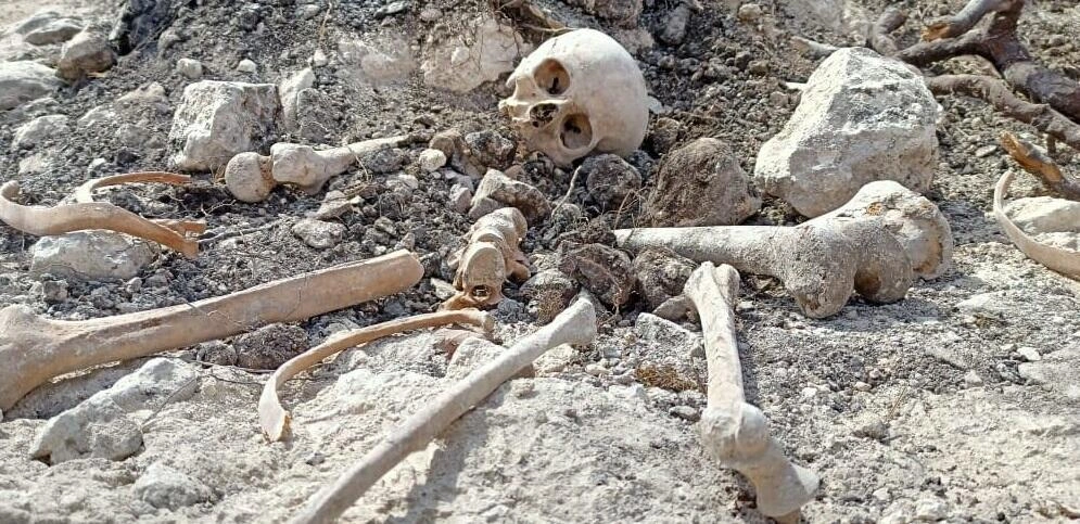 Ağdamda insan skeletinin qalıqları tapıldı