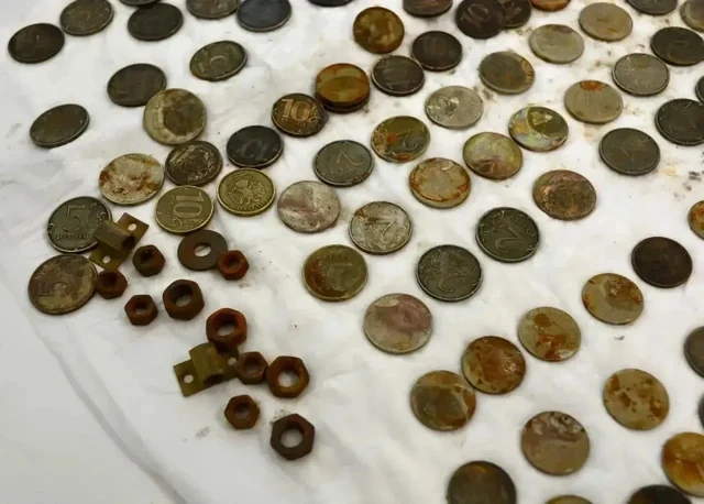 Şok hadisə: Rusiyada kişinin mədəsindən 227 yad cisim çıxarıldı