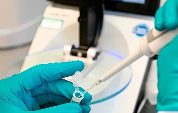 Afrikada Ebola təhlükəsi: ÜST fövqəladə vəziyyət elan edib
