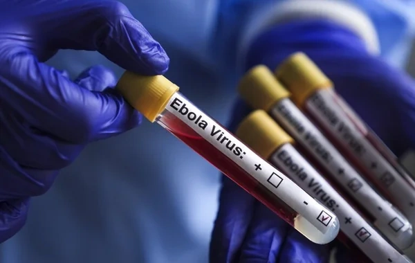 İtaliyada Ebola virusuna yoluxma faktı aşkarlanıb?