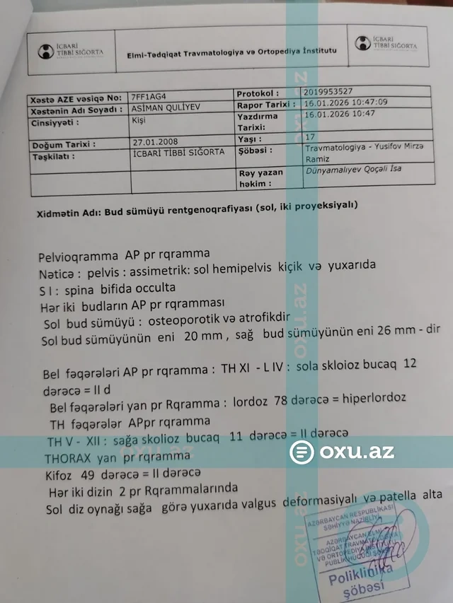 Qəzada ağır xəsarət alan gəncin əlillik müavinətinin dayandırılmasına AYDINLIQ GƏTİRİLİB - FOTO - VİDEO