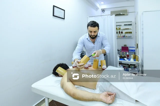 Ənənəvi müalicə üsulu olan hicama prosesi - FOTO