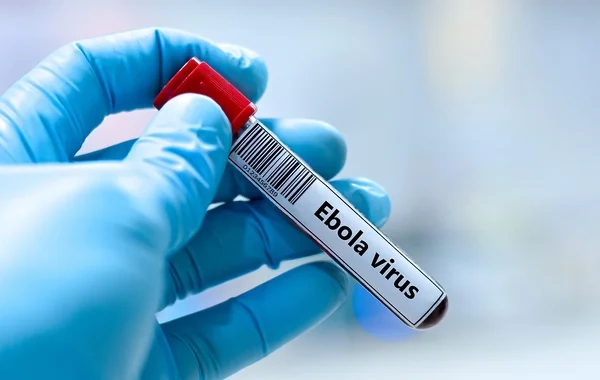 İsraildə Ebola təşvişi: Bir nəfər nəzarət altına alınıb