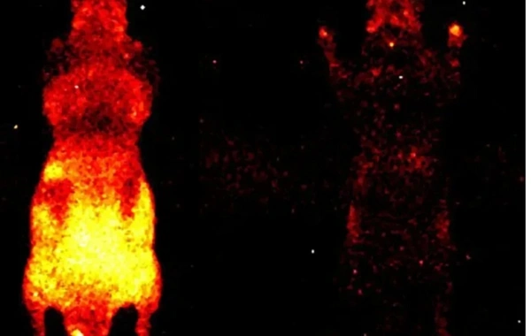 Bədənimiz işıq saçırmış: Elmi təcrübə heyrətləndirdi