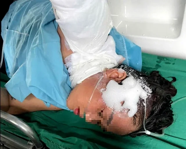Vyetnamda qorxulu anlar: Hərəkətdə olan motosikletçi qadını ildırım vurdu - FOTO/VİDEO
