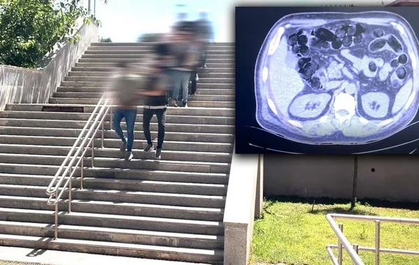 Türkiyədə əməliyyat: Əcnəbi sərnişinlərin mədəsindən 2.7 kiloqram narkotik aşkarlandı - FOTO