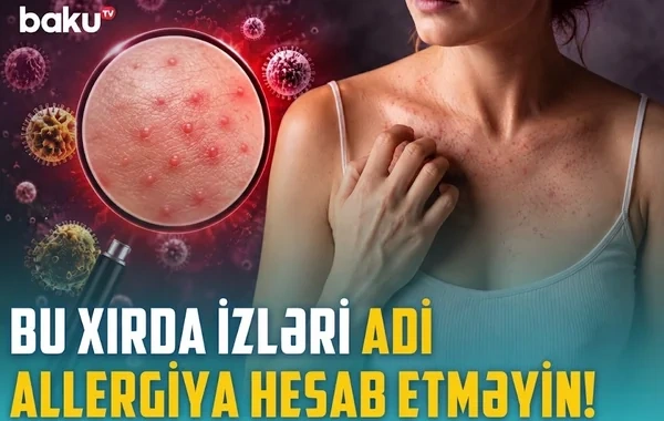 Qısa təmasla yoluxma riski: Ev heyvanınız infeksiya mənbəyinə çevrilə bilər - VİDEO