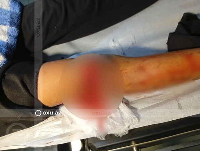 Bakıda VAZ-2107 11 yaşlı uşağı vurub qaçdı, polis yaxaladı - FOTO