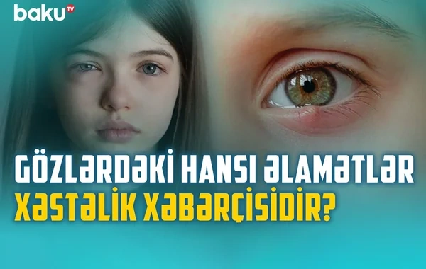Gözlərimizin zəifləməməsi üçün nə etməli? - VİDEO