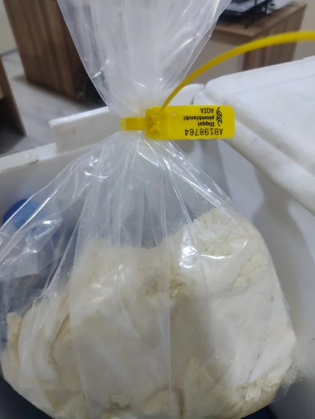 Azərbaycanda baş verən qida zəhərlənmələri araşdırıldı: Bakteriyalar aşkar olundu - FOTO