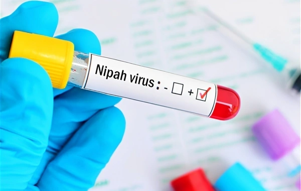 Banqladeşdə Nipah virusundan ilk ölüm hadisəsi qeydə alındı