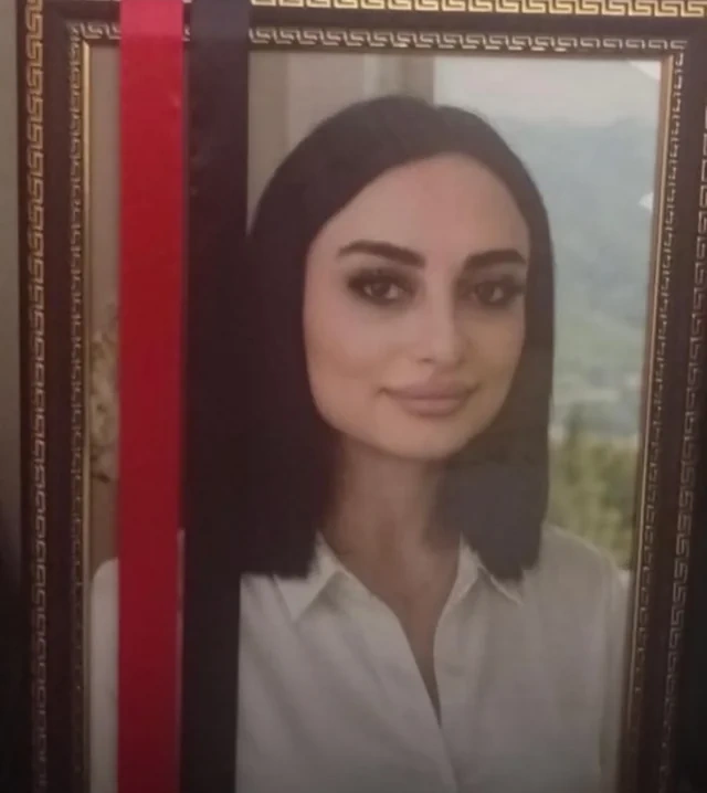 Bakıda rinoplastika əməliyyatından sonra iflic olan 34 yaşlı qadın öldü - FOTO
