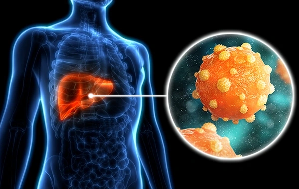 Azərbaycanda hepatit B virusuna yoluxanların sayı kəskin azalıb