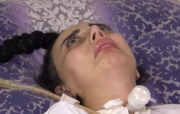 Bakıda rinoplastika əməliyyatından sonra iflic olan 34 yaşlı qadın öldü - FOTO