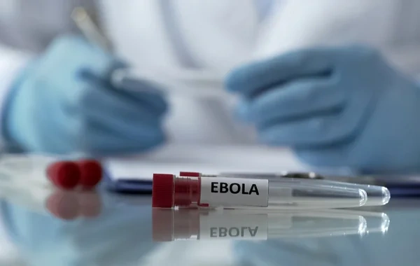Fransada Ebolaya ilk yoluxma faktı qeydə alındı